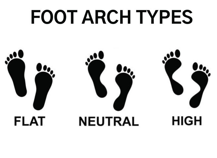 foot arch types